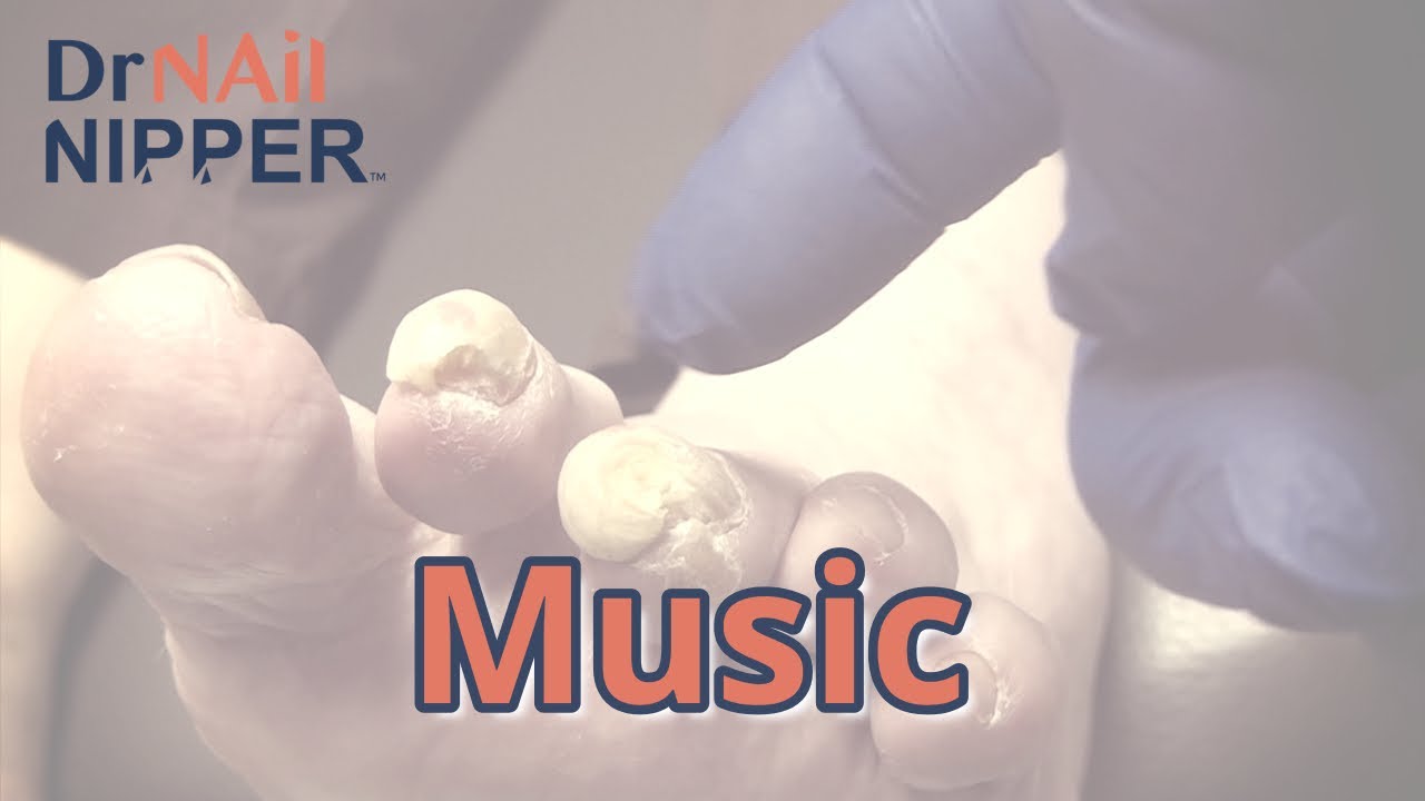 Dr Nail Nipper - Chunks and Gunk #9 Music (2021) 3