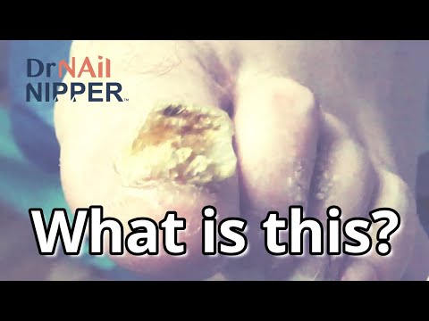 What is this? Thick as Texan Toenails. FEET-ure Friday (2021) 1