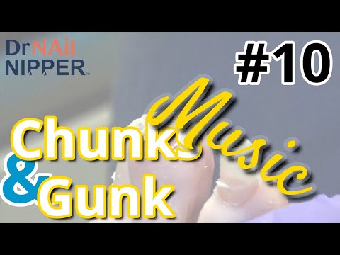 Dr Nail Nipper Chunks and Gunk #10 Music (2021) 1