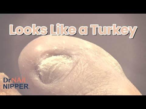 Thanksgiving 2021 - He Fell Asleep. Intro #1 1