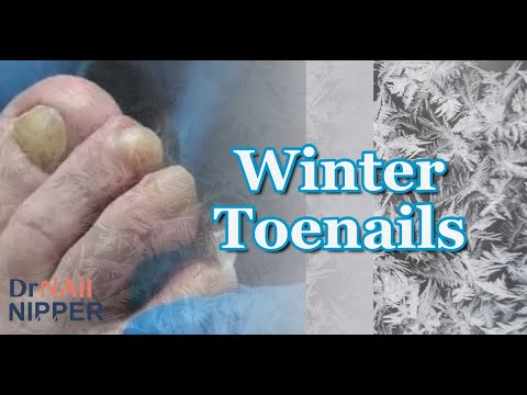 Winter Toenails for the Winter - Throwback 1