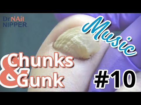 Dr Nail Nipper #10 Music - Rewind (2021) 1