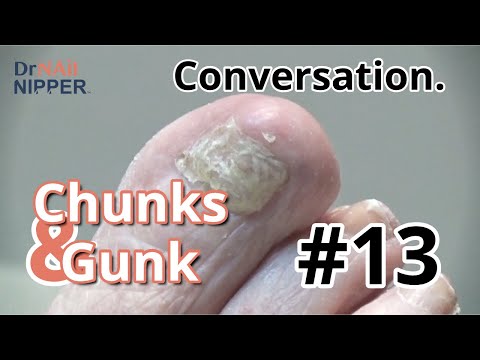 Chunks and Gunk #13 Conversation (2021) 1