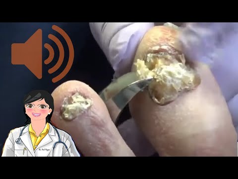 Epic Nails - Epic Music 1