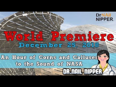 One Hour of Music - Corns and Calluses to the Sound of NASA - Dr Nail Nipper 1