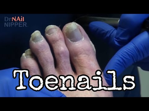 Depression and Toenails Discussion [Throwback] 1