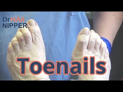 Toenails and COVID Discussion (2021) 1