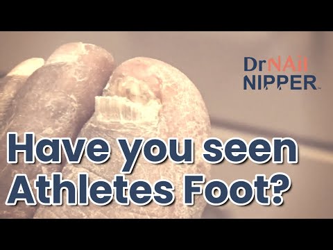 FEET-ure Friday (2022) 1