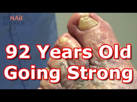 FEET-ure Friday (2022) 1