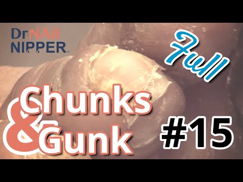 Chunks and Gunk #15, Dr Nail Nipper Talking (2022) 1