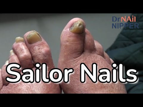 Sailor Toenails - Throwback Thursday 1