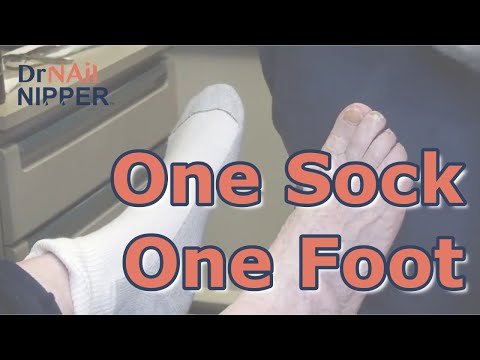 Throwback Podiatrist/Doctor's Eye View for Curvy Toenails 1