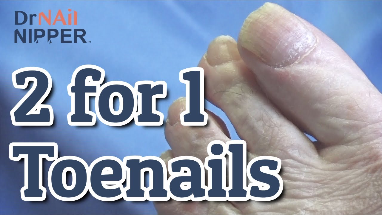 Toenails 2 for 1. FEET-ure Friday (2022) 4