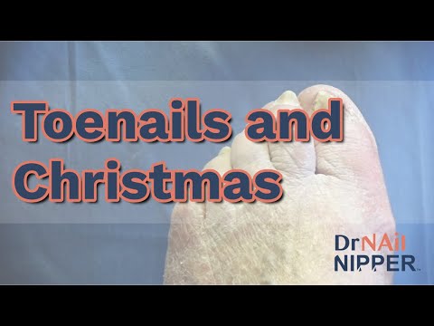 Christmas and Cutting Toenails. FEET-ure Friday (2022) 1