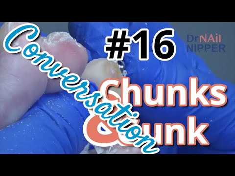 Chunks and Gunk #16 with Dr Nail Nipper Discussion (2022) 1