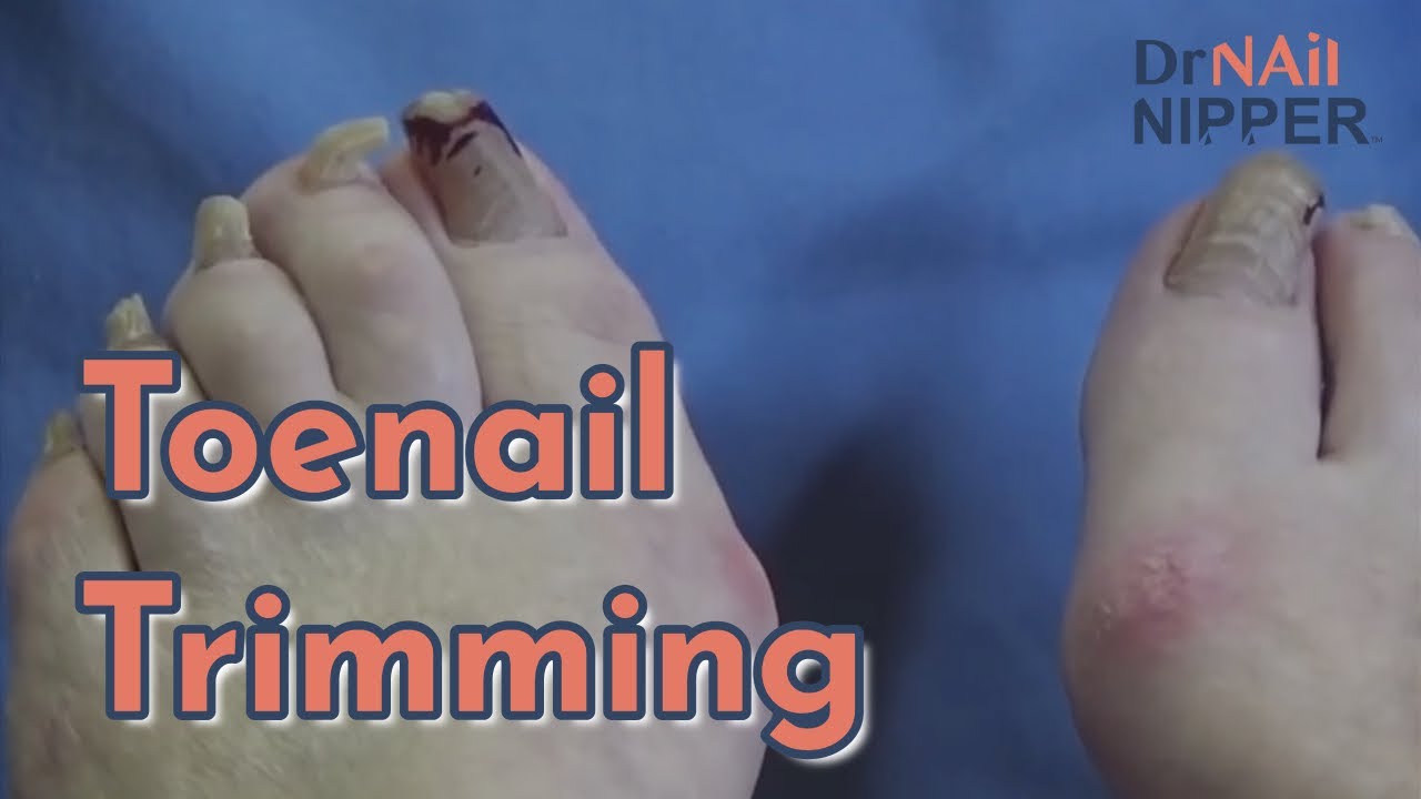 Pre-Quarantine Toenail Trimming - Throwback Thursday 5