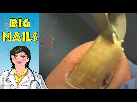 Crusty Highlights and Music 4 1