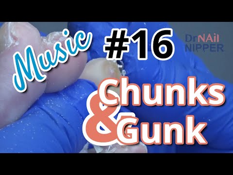 Chunks and Gunk #16 with Music 1