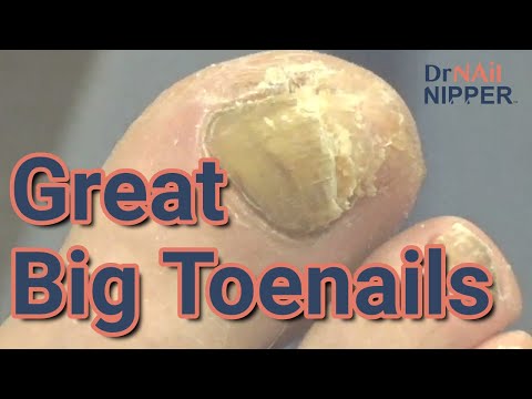 Great Big Toenails. Aquarium. FEET-ure Friday (2022) 1