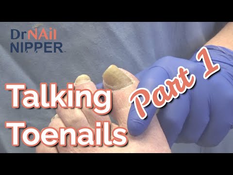 Part 1.... Talking Toenails, Fungus, and New Jersey. (2022) 1