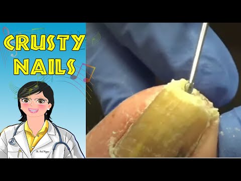 Crusty Highlights and Music 6 1