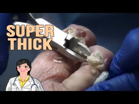 More Super Thick Nails 1
