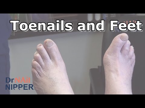 NYPD and Toenails - Throwback Thursday 4