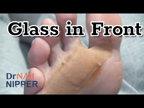 Glass in Her Foot (2022) 1