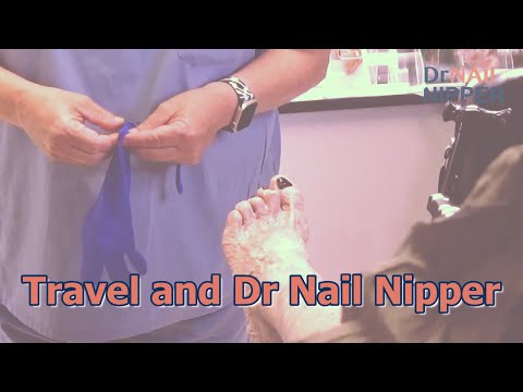 Travel Writer and Dr Nail Nipper. Friday FEETure (2022) 1