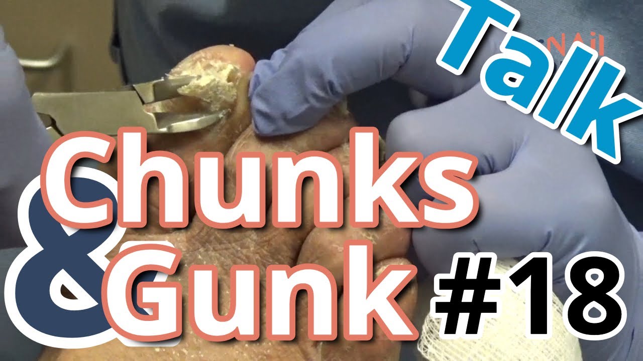 FEET-ure Friday (2022) 3