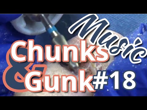 Chunks and Gunk #18 Music (2022) 1