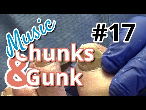 Chunks and Gunk #17 - Music (2022) 1