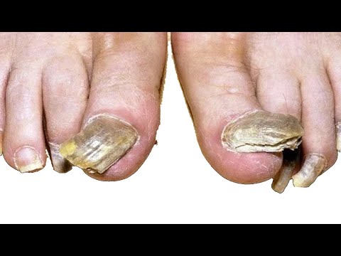 Ramshorn Nails and Music with Dr. Nail Nipper 1