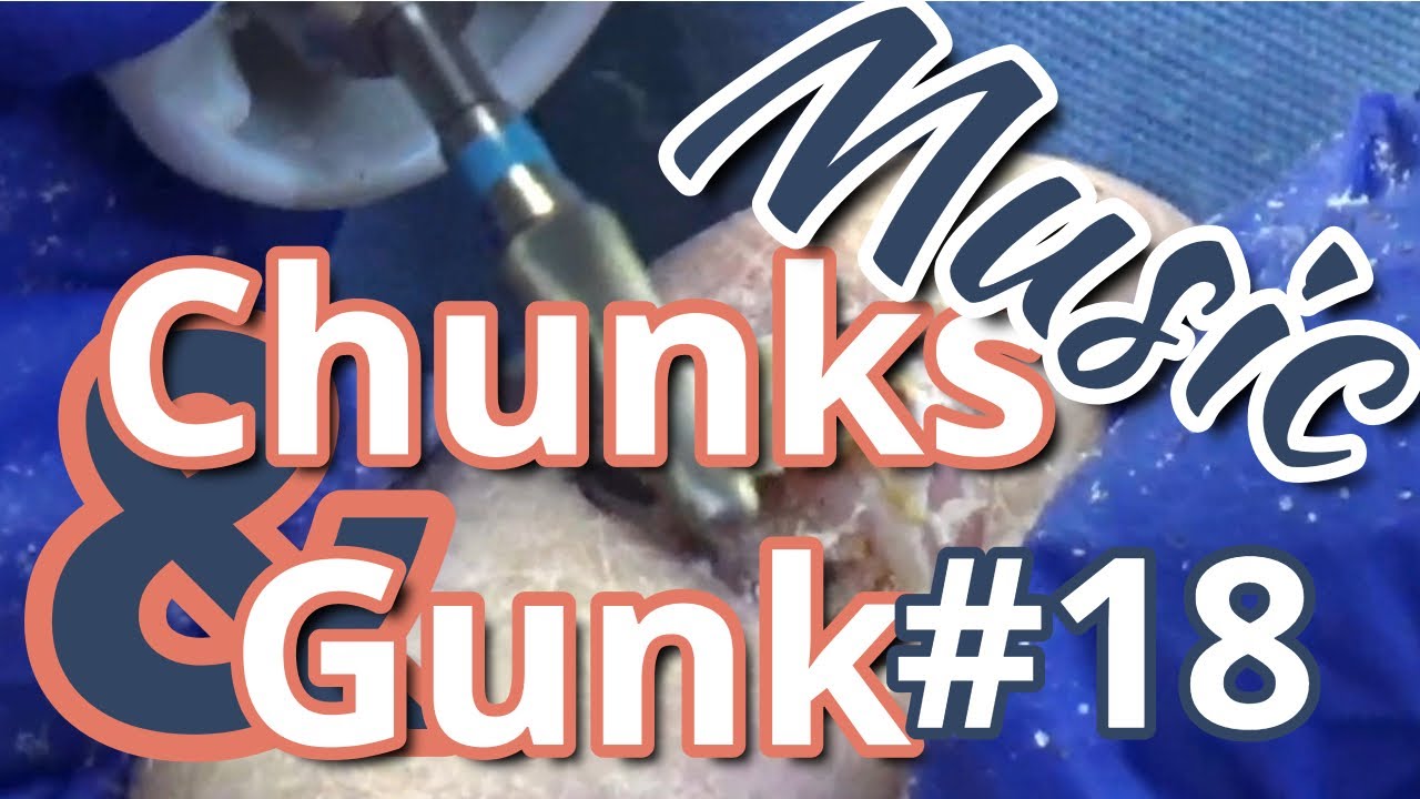 Chunks and Gunk #18 Music (2022) 2