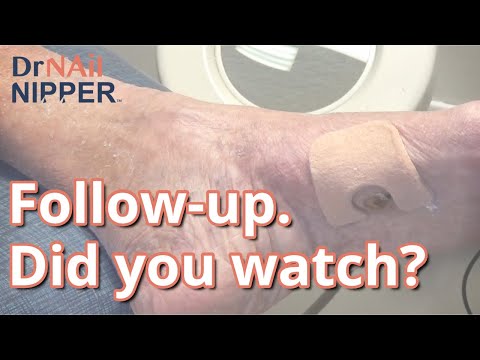 Callus Tuesday -- Rock or Callus Follow-up (2022) 1