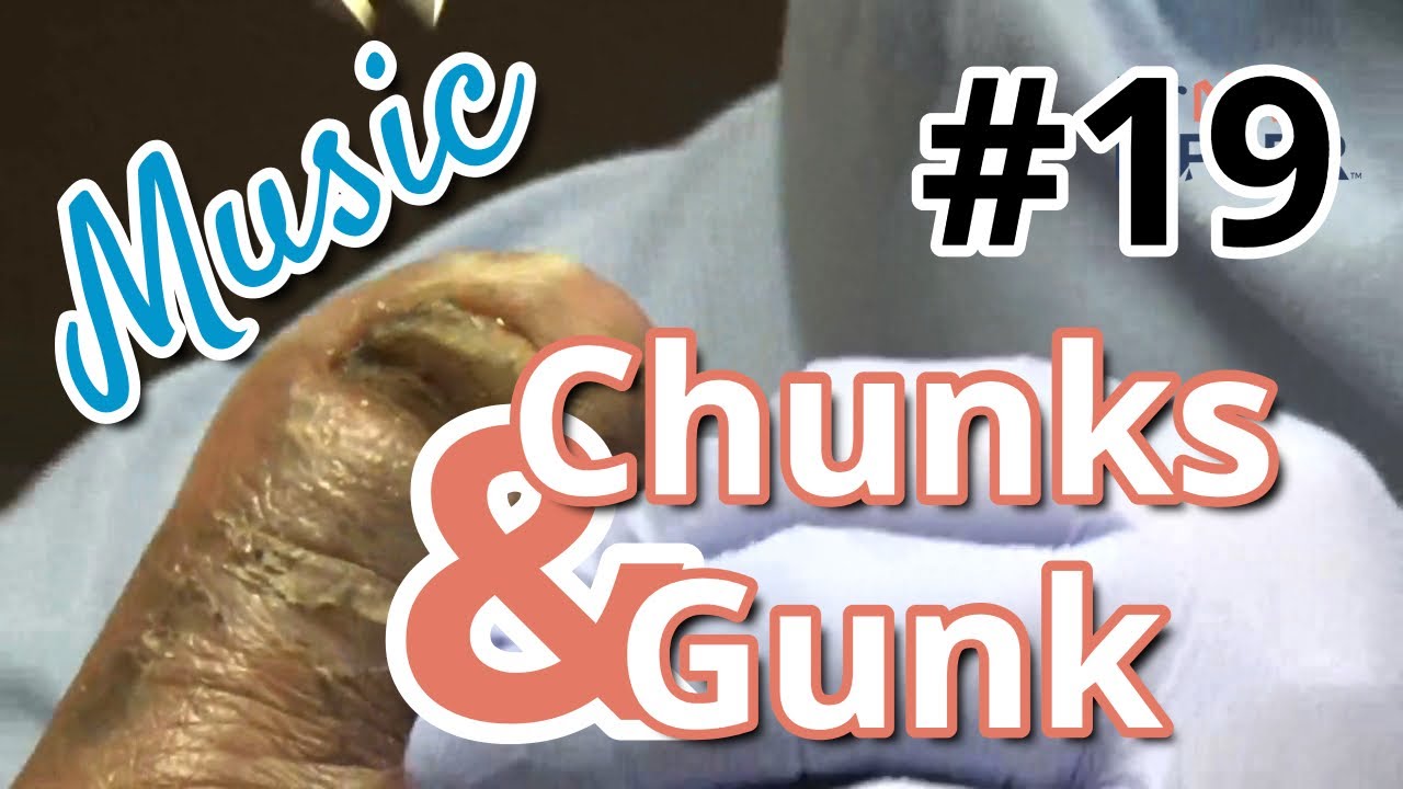 Chunks and Gunk #19 Music (2022) 1