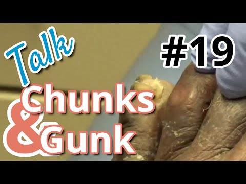 Chunks and Gunk #19 Talk (2022) 1