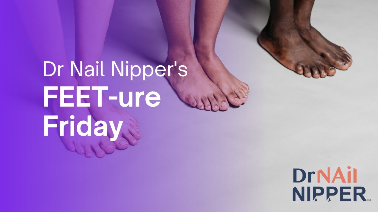 FEET-ure Friday (2022) 1