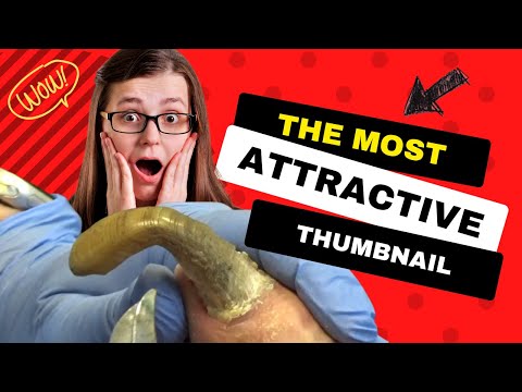 Chunks and Gunk #21 - Big Toenail Mixtape 1