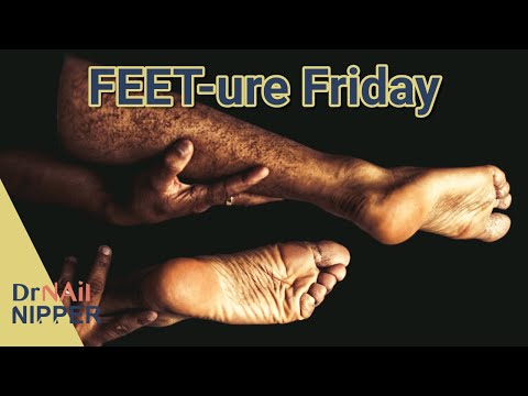 FEET-ure Friday (2022) 1