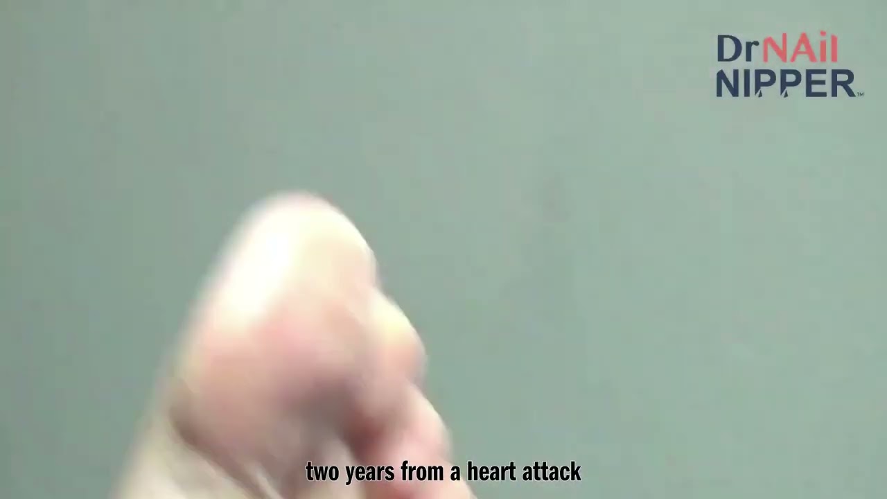 Some Callus Tuesday 1