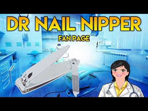 Thick Callus Removal! Dr. Nail Nipper! Queen of Feet 1