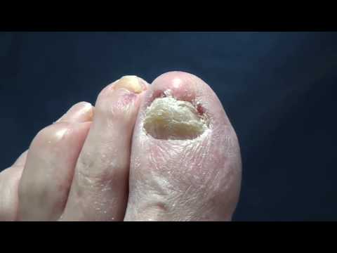 All Star Doctors - Bonus Nail Trimming with Dr. Nail Nipper! 1