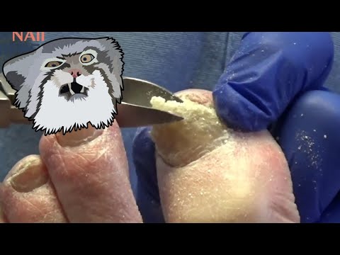 Big Chonky Nail - and Music 1