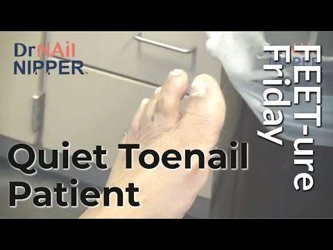 Quiet Toenail Patient at the shelter (2022) 1