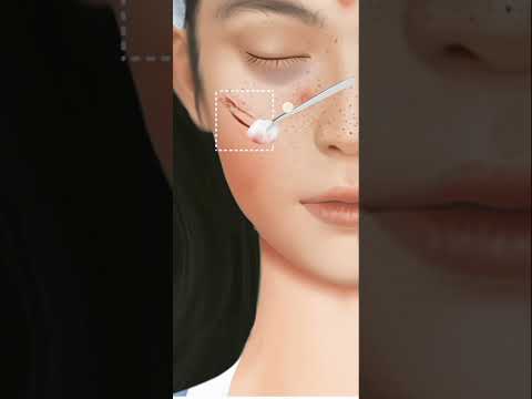 Beautiful Face laser treatment and cuts mark first Aid ASMR #short #viral #makeup #shorts #tiktok 1