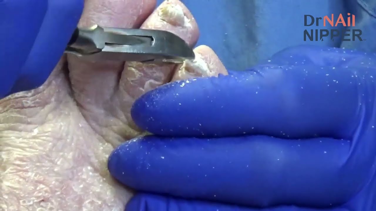 FEET-ure Friday (2022) 2