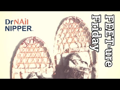 FEET-ure Friday (2022) 1