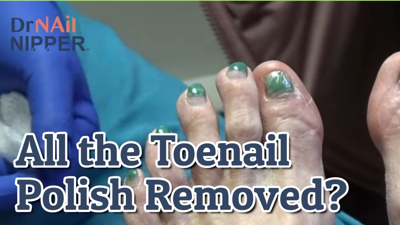 Green Toes and Ham (or maybe Turkey) Foot Care and Green Polish for Toenails Dr Nail Nipper (2023) 2