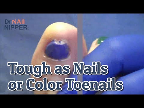 Nails to Toenail with Nail Polish. Not Hammer Toes. FEET-ure Friday (2023) 1